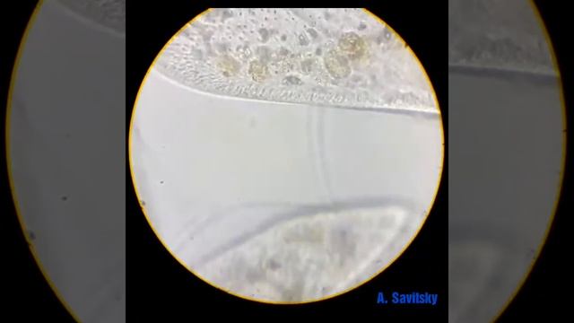 Инфузории туфельки/ Ciliates Paramécium caudátum 1350х смотреть онлайн