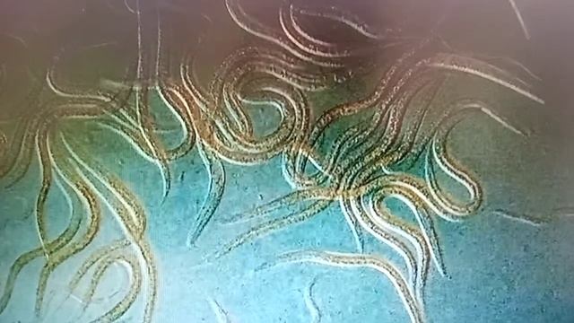 Как просто избавиться от нематод, без вреда для здоровья! смотреть онлайн