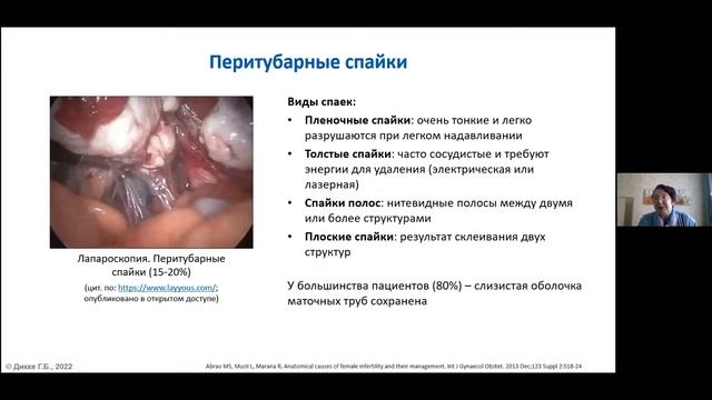 Бесплодие на фоне ВЗОМТ. Традиционные и современные подходы к терапии. Дикке Г.Б. смотреть онлайн