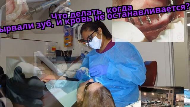 Что делать, когда вырвали зуб, и кровь не останавливается? смотреть онлайн