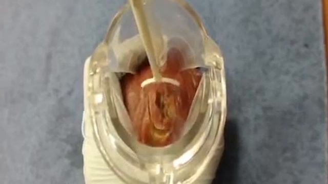 Тренировка работы на мясе Гинекология