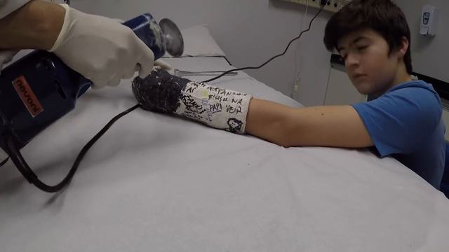 FINALMENTE TIREI O GESSO!!! смотреть онлайн