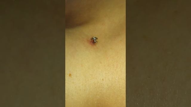 Установка микродермала, обучение смотреть онлайн