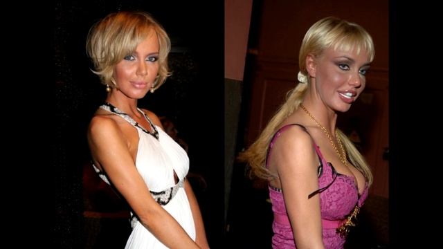 ПЛАСТИКА пошла НА ПОЛЬЗУ! Стали красотками! смотреть онлайн