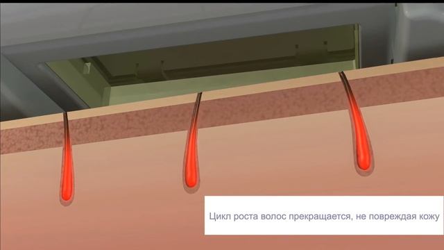 фотоэпилятор Remington  I-Light IPL6000F