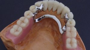 Виды протезирования А О  Каранин