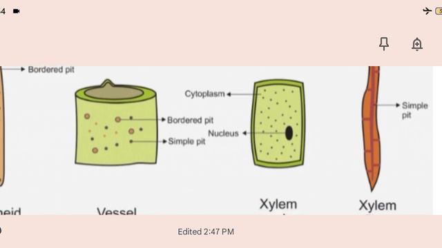 Xylem(जाइलम )|Complex Permanent Tissue|#tgt_pgtbiology #ltgrade #bsc #uptgtpgtbiology#neetbiology