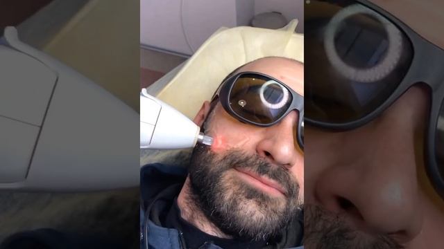 Лазерная эпиляция на лучшем аппарате SOPRANO XL