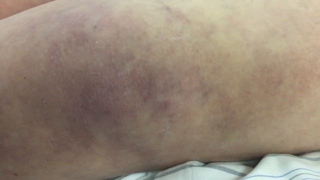 SepsisAkademie mit Dr. Sebastian Casu "Sepsis in der Präklinik" смотреть онлайн