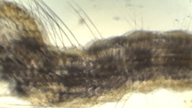 Anopheles larvae смотреть онлайн