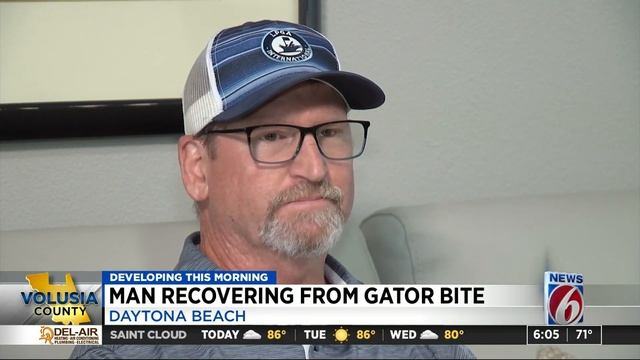 Florida man answers knock at door, gets attacked by alligator смотреть онлайн
