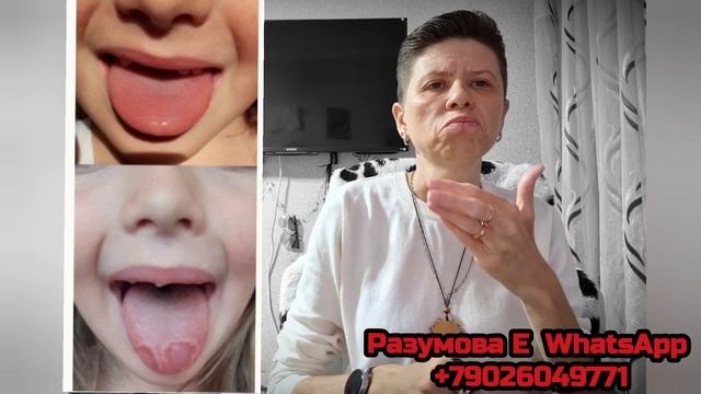 Пятна на языке. смотреть онлайн