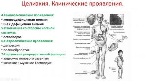 Целиакия