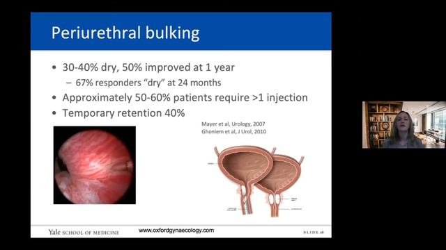 Stress Urinary Incontinence in Women смотреть онлайн