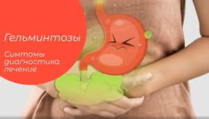 Гельминтозы. Симптомы. Диагностика. ЛЕЧЕНИЕ.