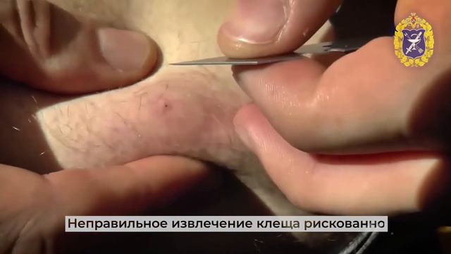 Медицинская помощь в Одинцово при поражении клещами смотреть онлайн