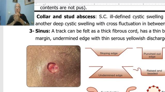 Lymphatic disorders in Arabic 4 (T.B lymphadenitis, part 2 ) , by Dr. Wahdan смотреть онлайн