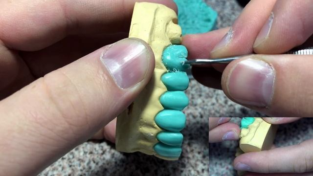 Серия видео моделировки зубов верхней челюсти. Как смоделировать зуб? Моляр, моделирование из воска смотреть онлайн