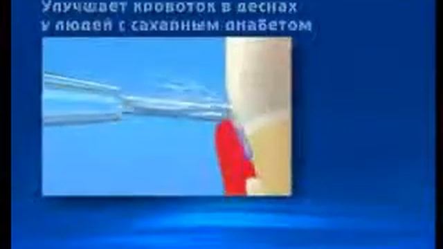 Ирригаторы смотреть онлайн