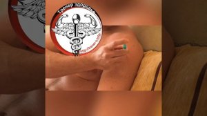 Инъекция плечо. Укол в плечи. Инъекция в дельту. Профессиональный урок - от Тренера здоровья