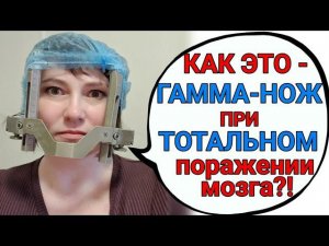 Мне сделали гамма-нож № 2 по квоте в МИБС. Как все это происходит?