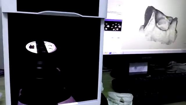 Silicon gum scanning on the mode of single crown смотреть онлайн