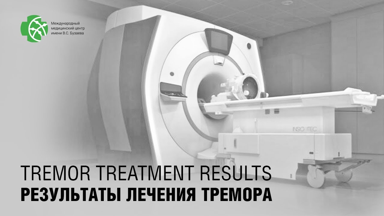 Ранние послеоперационные результаты МР-ФУЗ терапии тремора.  Краткая характеристика медикаментозного