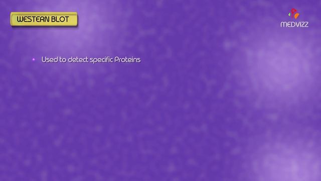 Western blot , Southern blot , Northern blot , South western Blot - Animation смотреть онлайн