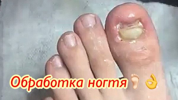 Обработка ногтя??