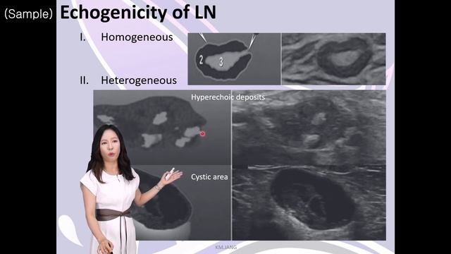 초음파교육_Lymph node : Pathology 강의 샘플영상_SONOUS 대표강사 : 장경미 смотреть онлайн