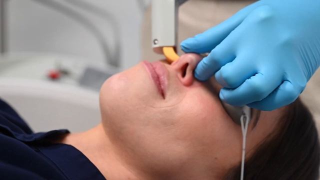 Excel V Combination Laser for Spider Veins and Leg Veins смотреть онлайн