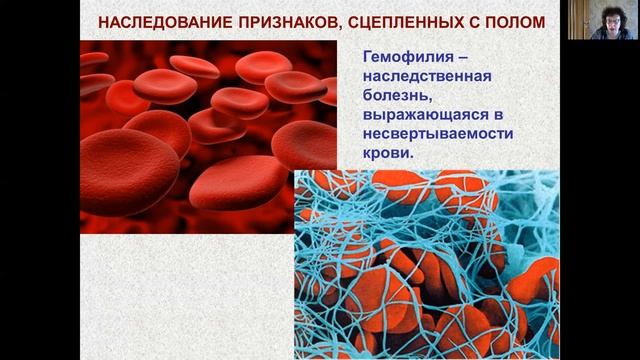 Сцепленное с полом наследование смотреть онлайн