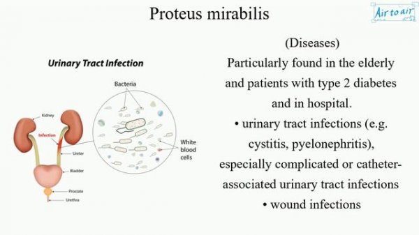 Proteus mirabilis