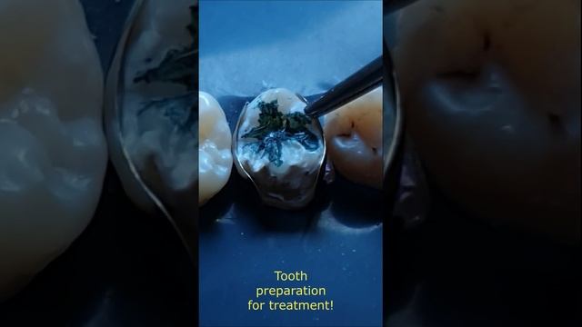 DARK HISTORY!??? смотреть онлайн