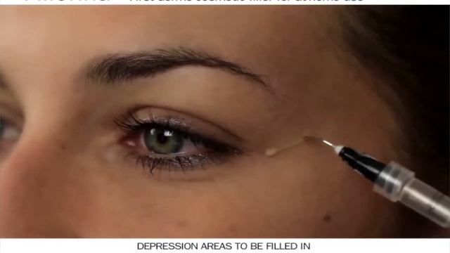 Kuidas kasutada Fillerina täiteaine komplekti? смотреть онлайн