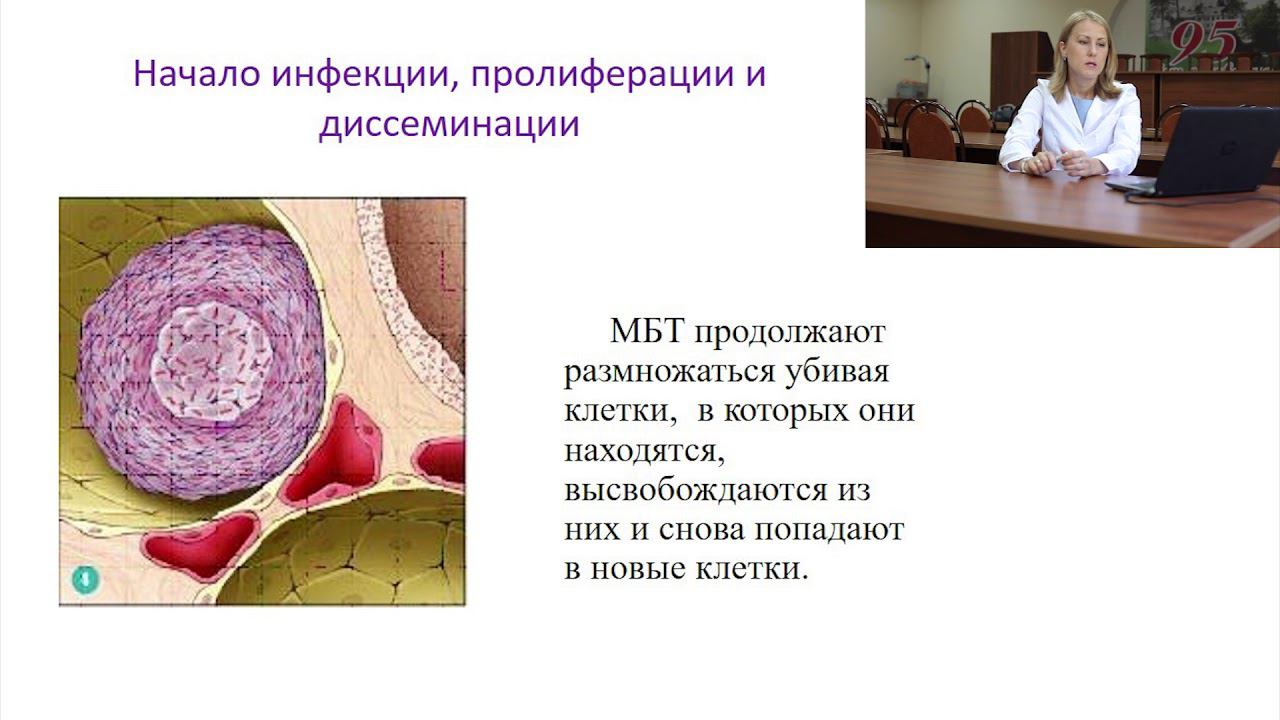 Патогенез туберкулеза смотреть онлайн