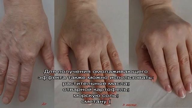 Омоложение рук смотреть онлайн