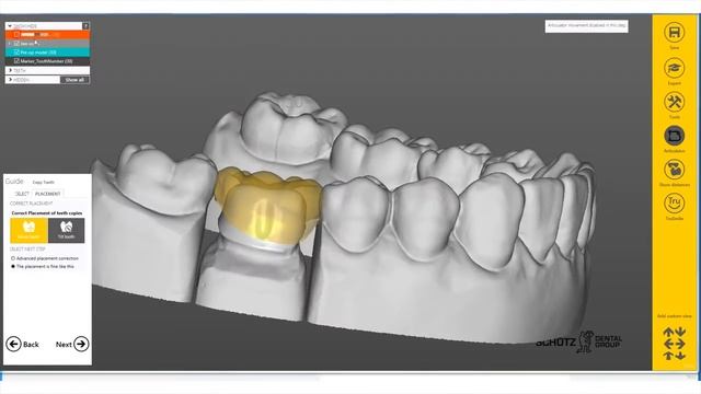 Dental-EXOCAD HELP - TUTORIAL-Modelling reduzed Crown смотреть онлайн