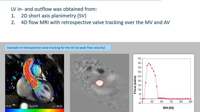 Vivian Kamphuis - In‐scan and scan–rescan assessment of LV in-/outflow volumes by 4D versus 2D смотреть онлайн
