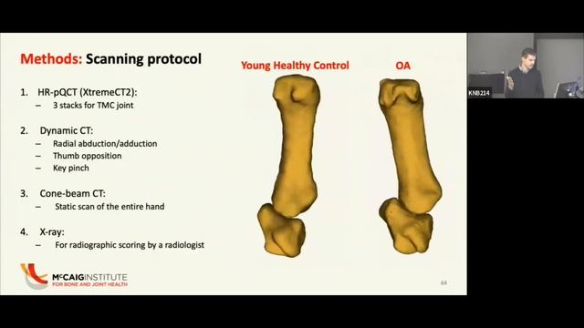 Static and dynamic CT imaging of the structure-function in hand osteoarthritis by Mike Kuczynski смотреть онлайн