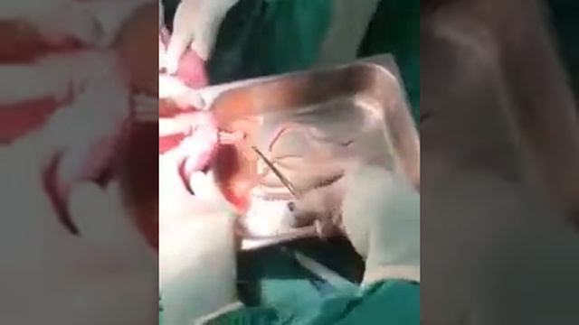ماذا يحصل لو لم تغسل يديك جيدا قبل الطعام شاهد وتعجب смотреть онлайн