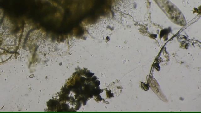 Ciliates Blepharisma или Инфузория Блефаризма смотреть онлайн