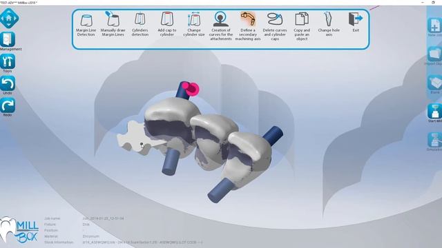 MillBox - How to Process an Attachment смотреть онлайн