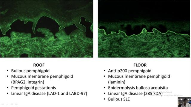 Immunofluorescence in dermatology- Dr. Rhea смотреть онлайн