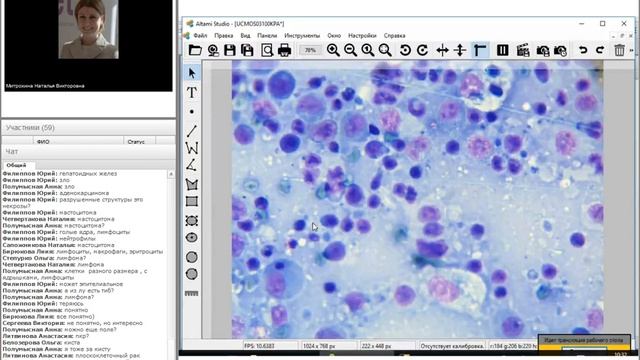 Клинико-морфологическая диагностика опухолей кожи 2. Митрохина Наталья смотреть онлайн