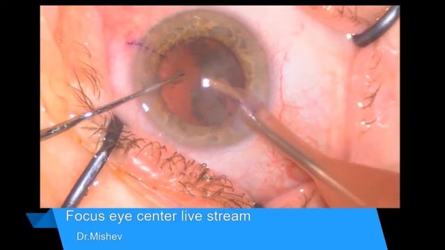 Lentis Comfort Lukan Mishev Live Stream смотреть онлайн
