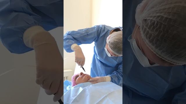 Удаление второго подбородка с помощью лазерного липолиза |Beauty Clinic Roksolana смотреть онлайн