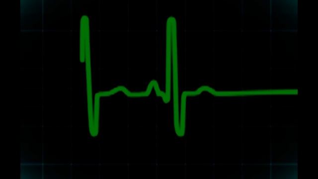 Биение сердца...Посмотрите До конца! смотреть онлайн