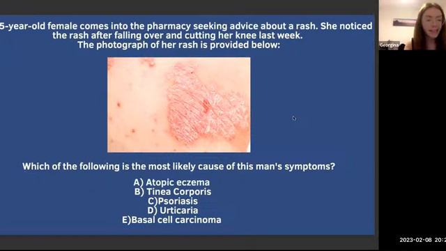 preregshortcuts: OTC (Acne) with Georgina смотреть онлайн