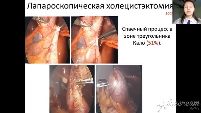 Конгресс молодых учёных 2020. Секция "Педиатрия". смотреть онлайн